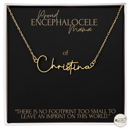 Encephalocele Mama: Cursive Name Keepsake